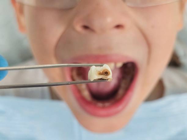 Best Urgent Dental Care in Urania, LA