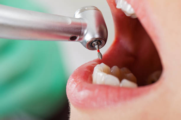 , LA Emergency Dentist Company